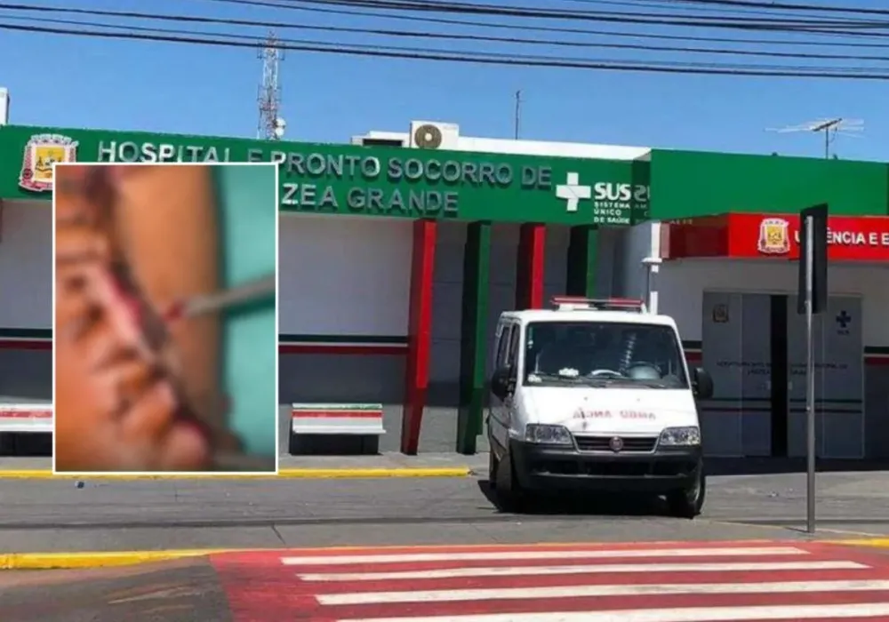 Adolescente tem larvas encontradas em ferimento durante internação em Várzea Grande