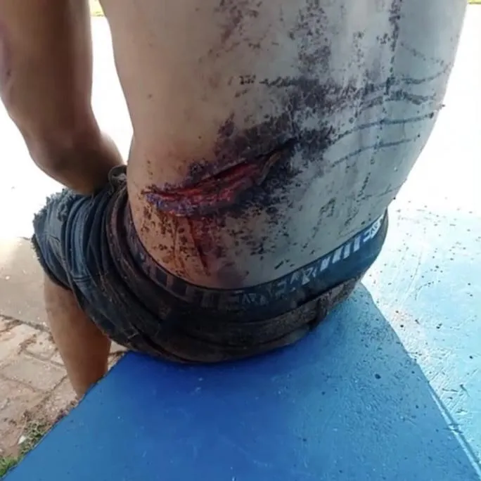 Homem é socorrido após tentativa de homicídio em Poxoréu